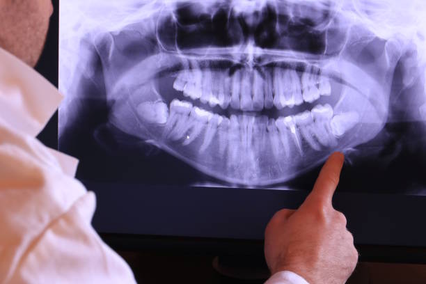 Best Emergency Treatment for Dental Infections or Abscesses in Smithton, IL