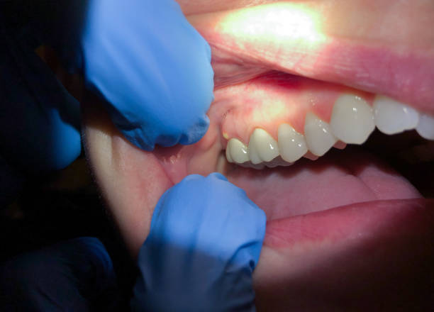 Best Emergency Root Canal Treatment in Smithton, IL