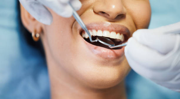 Best Emergency Root Canal Treatment in Smithton, IL
